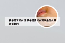 孩子后背长白斑 孩子后背长白斑块是什么原因引起的