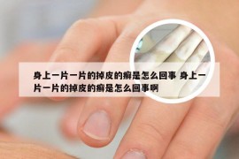 身上一片一片的掉皮的癣是怎么回事 身上一片一片的掉皮的癣是怎么回事啊