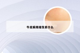 牛皮癣用维生素什么