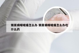 银屑病喉咙痛怎么办 银屑病喉咙痛怎么办吃什么药