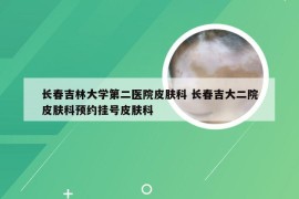 长春吉林大学第二医院皮肤科 长春吉大二院皮肤科预约挂号皮肤科