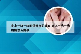 身上一块一块的像癣治的好么 身上一块一块的癣怎么回事