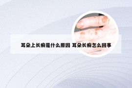 耳朵上长癣是什么原因 耳朵长癣怎么回事