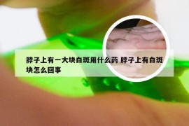 脖子上有一大块白斑用什么药 脖子上有白斑块怎么回事