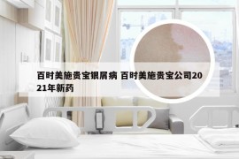 百时美施贵宝银屑病 百时美施贵宝公司2021年新药