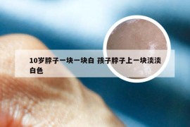 10岁脖子一块一块白 孩子脖子上一块淡淡白色