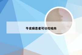 牛皮癣患者可以吃啥肉