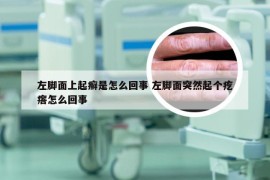 左脚面上起癣是怎么回事 左脚面突然起个疙瘩怎么回事