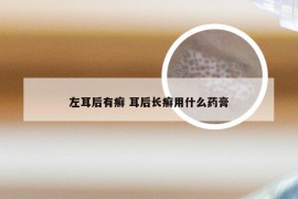 左耳后有癣 耳后长癣用什么药膏