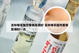 吉林哪家医院看银屑病好 吉林哪家医院看银屑病好一点