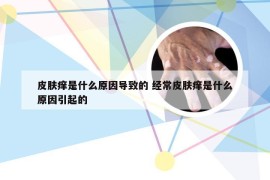 皮肤痒是什么原因导致的 经常皮肤痒是什么原因引起的