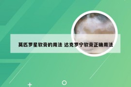 莫匹罗星软膏的用法 达克罗宁软膏正确用法