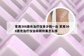 家用308激光治疗仪多少钱一台 家用308激光治疗仪治白斑效果怎么样