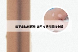 四平皮肤科医院 四平皮肤科医院电话