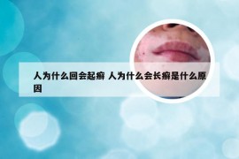 人为什么回会起癣 人为什么会长癣是什么原因