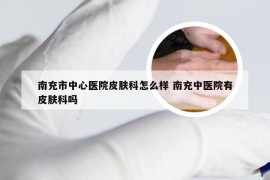 南充市中心医院皮肤科怎么样 南充中医院有皮肤科吗