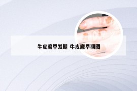 牛皮廨早发期 牛皮廨早期图