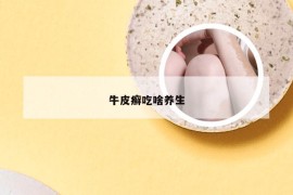 牛皮癣吃啥养生