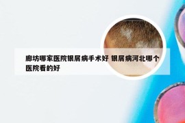 廊坊哪家医院银屑病手术好 银屑病河北哪个医院看的好