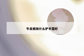 牛皮癣抹什么护手霜好