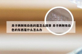 鼻子两侧有白色的是怎么回事 鼻子两侧有白色的东西是什么怎么办