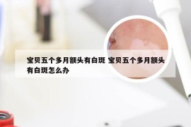 宝贝五个多月额头有白斑 宝贝五个多月额头有白斑怎么办