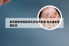 复芳曲按奈德尿素乳膏治牛皮癣 复方曲氨萘德乳膏