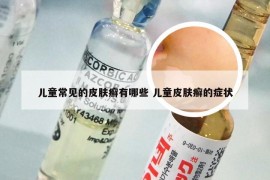 儿童常见的皮肤癣有哪些 儿童皮肤癣的症状