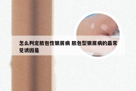 怎么判定脓包性银屑病 脓包型银屑病的最常见诱因是
