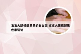 宝宝大腿根部黑黑的有白斑 宝宝大腿根部黑色素沉淀