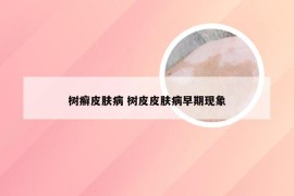 树癣皮肤病 树皮皮肤病早期现象
