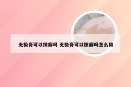 无极膏可以擦癣吗 无极膏可以擦癣吗怎么用