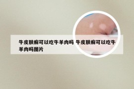 牛皮肤癣可以吃牛羊肉吗 牛皮肤癣可以吃牛羊肉吗图片