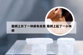 胳膊上长了一块癣有皮屑 胳膊上起了一小块癣