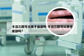 卡泊三醇可以用于面部吗 卡泊三醇可以用于面部吗?