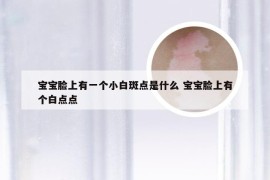 宝宝脸上有一个小白斑点是什么 宝宝脸上有个白点点