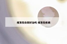 爆发性白斑好治吗 爆发性疾病