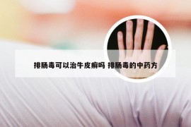 排肠毒可以治牛皮癣吗 排肠毒的中药方