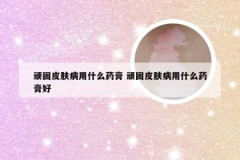 顽固皮肤病用什么药膏 顽固皮肤病用什么药膏好