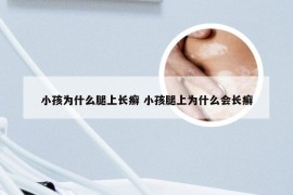 小孩为什么腿上长癣 小孩腿上为什么会长癣