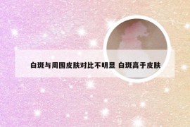 白斑与周围皮肤对比不明显 白斑高于皮肤