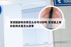 宝宝腿部有白斑怎么办可以好吗 宝宝腿上有白色斑点是怎么回事
