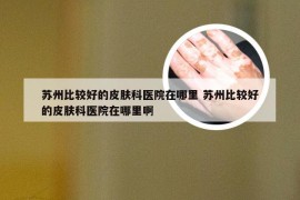 苏州比较好的皮肤科医院在哪里 苏州比较好的皮肤科医院在哪里啊