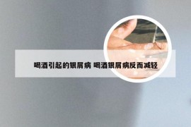 喝酒引起的银屑病 喝酒银屑病反而减轻