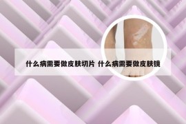 什么病需要做皮肤切片 什么病需要做皮肤镜