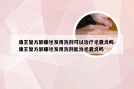 康王复方酮康唑发用洗剂可以治疗毛囊炎吗 康王复方酮康唑发用洗剂能治毛囊炎吗