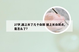 27岁,腿上长了几个白斑 腿上长白斑点,是怎么了?