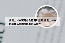 鼻梁上长白斑是什么原因引起的 鼻梁上长白斑是什么原因引起的怎么治疗