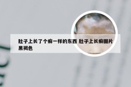 肚子上长了个癣一样的东西 肚子上长癣图片黑褐色