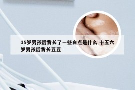 15岁男孩后背长了一些白点是什么 十五六岁男孩后背长豆豆